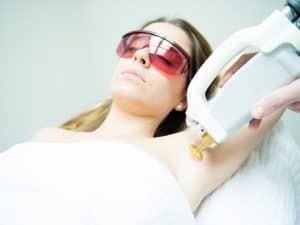 Choose Laser Hair Removal